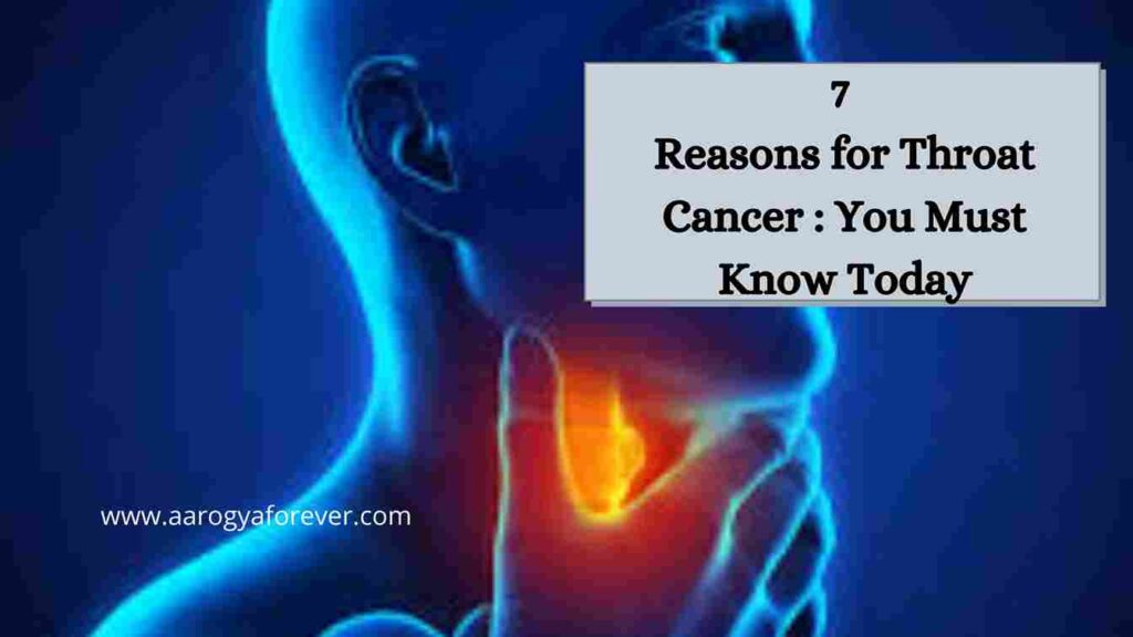 7 Reasons for Throat Cancer
