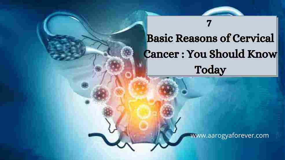 7 Basic Reasons of Cervical Cancer