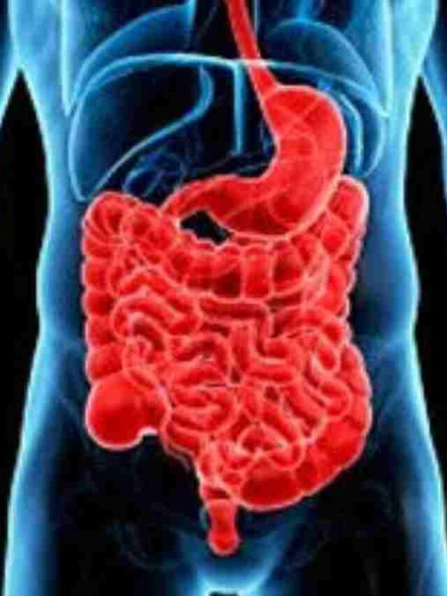 Reasons for Colon Cancer