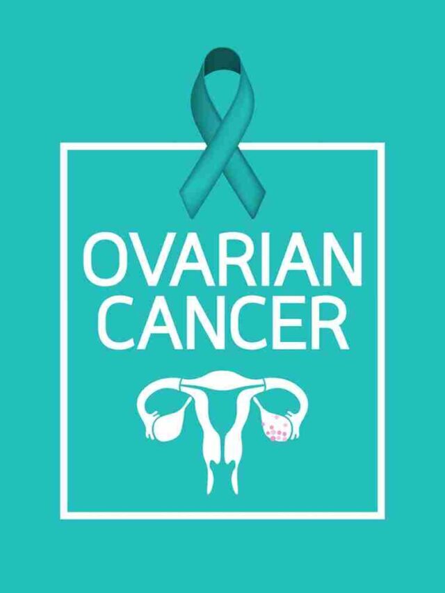 Reasons for Ovarian Cancer